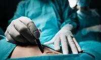 عمل لیپوماتیک چیست و چگونه انجام می‌شود؟ + مزایا و عوارض