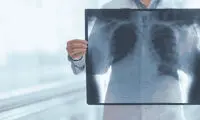 تحقیقات جدید؛ امید تازه برای شناسایی زودهنگام سرطان ریه