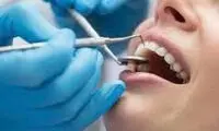 مراقب دندان‌هایتان باشید تا آلزایمر نگیرید!