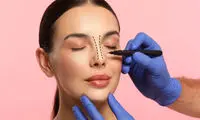همه چیز درباره جراحی بینی که باید بدانید