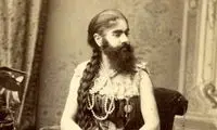 نوزادی که با سبیل به دنیا آمد!