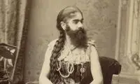 نوزادی که با سبیل به دنیا آمد!