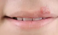 این ویروس حداقل ۵ هزار سال قدمت دارد 