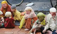 صاحبان عجیب‌ترین قیافه‌ها که از جامعه طرد شدند