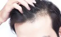 انقلابی در درمان ریزش مو! شامپوی جلبک ایرانی در صدا و سیما معرفی شد