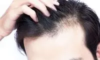 انقلابی در درمان ریزش مو! شامپوی جلبک ایرانی در صدا و سیما معرفی شد