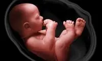 آمار شوکه کننده از قتل روزانه جنین در کشور 