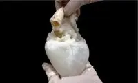 عضوی که ناجی انسان‌ها می‌شود!
