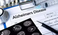 یک عامل مهم برای پیشگیری از آلزایمر را بشناسید