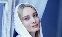 عکسی از چهره آفتاب سوخته خانم بازیگر