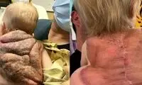 پسربچه‌ای که لاک‌پشت نینجا لقب گرفت!