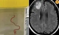 اتفاق باورنکردنی در مغز یک زن جهان را تکان داد!