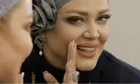 تزریق جدید لب‌های بهاره رهنما سوژه شد 