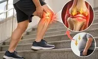 چرا زانو هنگام بالا رفتن از پله درد می‌گیرد و چه ارتباطی با اضافه‌وزن دارد؟