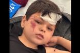 تصاویر این کودک فلسطینی طی ساعات اخیر پربازدید شد