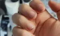 موجودات وحشتناکی که زیر ناخن انسان زندگی می‌کنند!