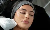 بهترین مرکز هایفو صورت و گردن در تهران؛ معرفی ۵ کلینیک