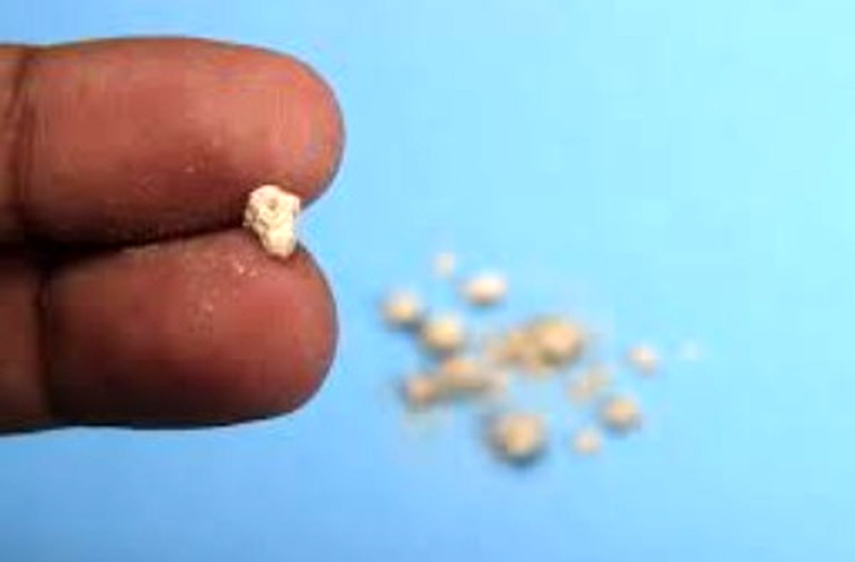   تصاویری از یک سنگ کلیه زیر میکروسکوپ 