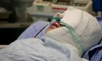 اسیدپاشی روی همسر سابق به‌ خاطر حضانت فرزند