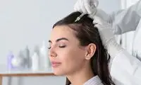 مزوتراپی مو چیست و چه فوایدی برای درمان ریزش مو دارد؟