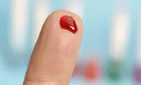 گامی بزرگ در تشخیص آلزایمر با یک روش ساده