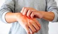علت خارش پوست بدن چیست؟