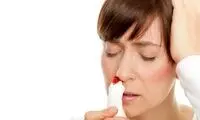 راههای پیشگیری از خون دماغ در تابستان