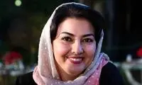 تغییر چهره باورنکردنی آناهیتا همتی و برادرش آرین
