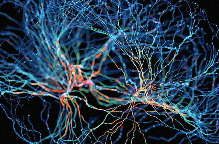 عکسی از چاپ سه‌بعدی بافت مغز انسان‌!