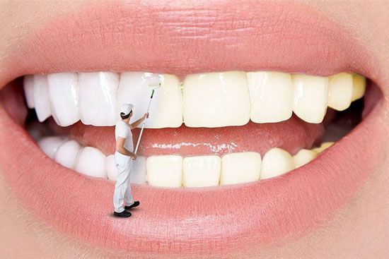 بهترین خمیر دندان‌های بازار برای سفید کردن دندان
