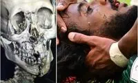 تصویری از جمجمه شکسته‌شده بازیکن عربستان