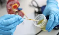 آیا دیدن ماده لزج مخاطی در ادرار طبیعی است؟