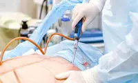 پیکرتراشی با دستگاه پال چگونه انجام می شود؟