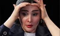 نورا هاشمی: بابام گفت بیا ببرمت بینی‌ات رو نچرال عمل کن