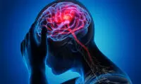 علائم هشدار دهنده‌ سکته مغزی