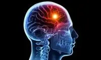 یک خطای دید جذاب که مغزت هنگ میکنه
