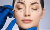 بهترین متخصص جراحی پلک چه ویژگی هایی دارد + معرفی 10 متخصص برتر