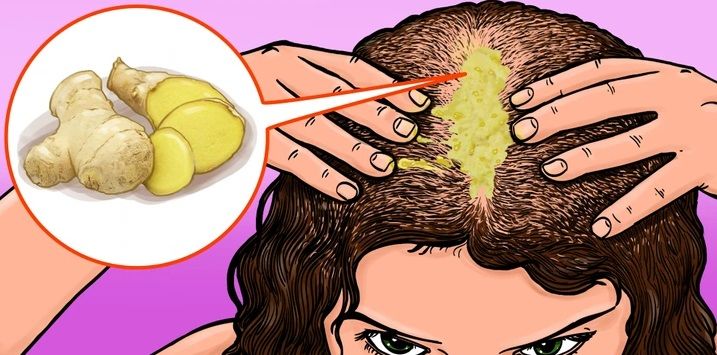 ۹ راه برای رشد طبیعی موها و فراموش کردن ریزش مو