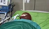 ماجرای اسیدپاشی هولناک روی پدر و دختر در تهران