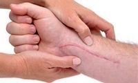 چرا جای زخم روی پوست باقی می‌ماند؟