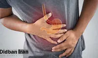 این خوراکی‌ها میکروب معده را از بین می‌برند