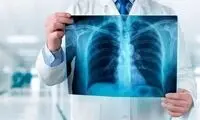 چه میزان از اشعه ایکس خطرناک است؟