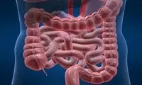 این کارها به روده آسیب می‌زند