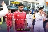 کاشت موی کنعانی‌زادگان بلای جان پرسپولیس شد!
