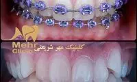 بهترین متخصص ارتودنسی دندان چه ویژگی هایی دارد؟ + معرفی 10 پزشک برتر