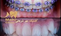 بهترین متخصص ارتودنسی دندان چه ویژگی هایی دارد؟ + معرفی 10 پزشک برتر