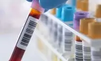 پیش‌بینی آلزایمر با این آزمایش خون پیشرفته!