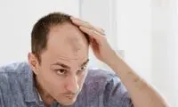این گیاه چینی باعث رشد مجدد مو می شود