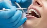 برای تقویت مینای دندان چه کنیم؟