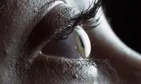کشف راهی جدید برای درمان نابینایی